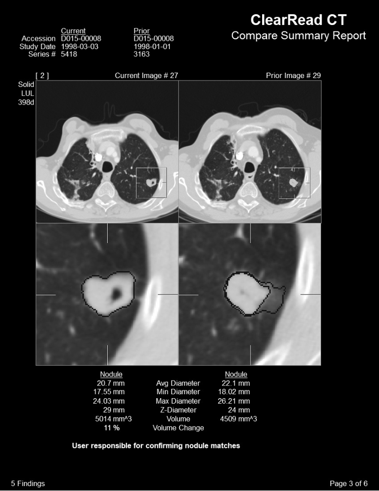 ClearRead CT Compare ClearRead CT Compare